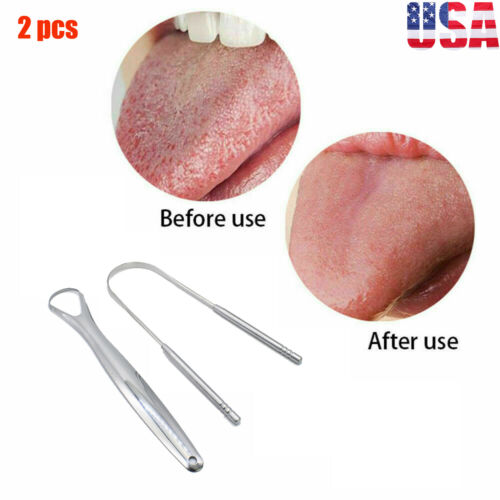 2×tongue Cleaner Scraper Stainless Steel Cleaner Fresh Breath Cleaning Oral Care